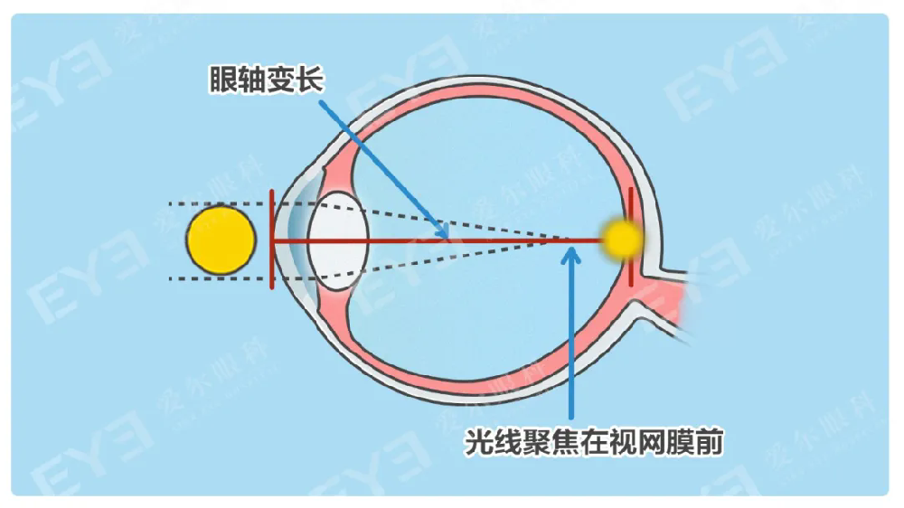 640.webp (2).png